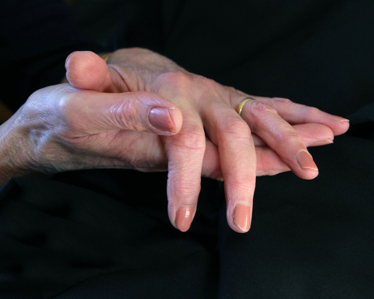 Mains âgées, ridées et déformées par l'arthrose.