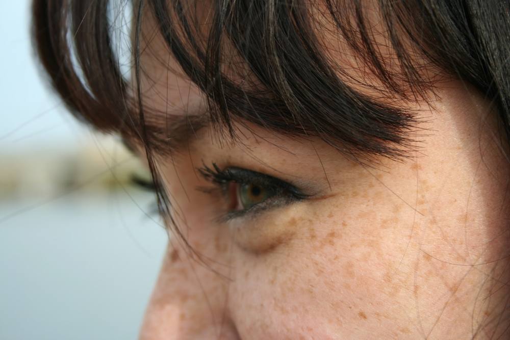 Une personne aux cheveux tachetés de taches de rousseur.